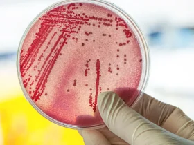 Escherichia coli