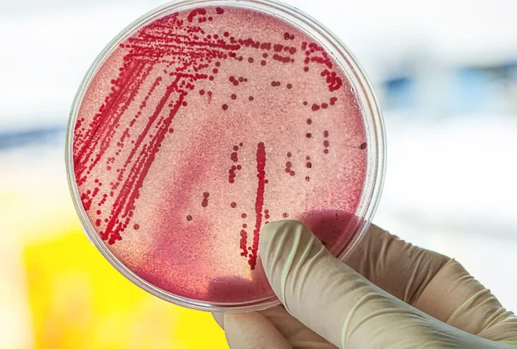 Escherichia coli