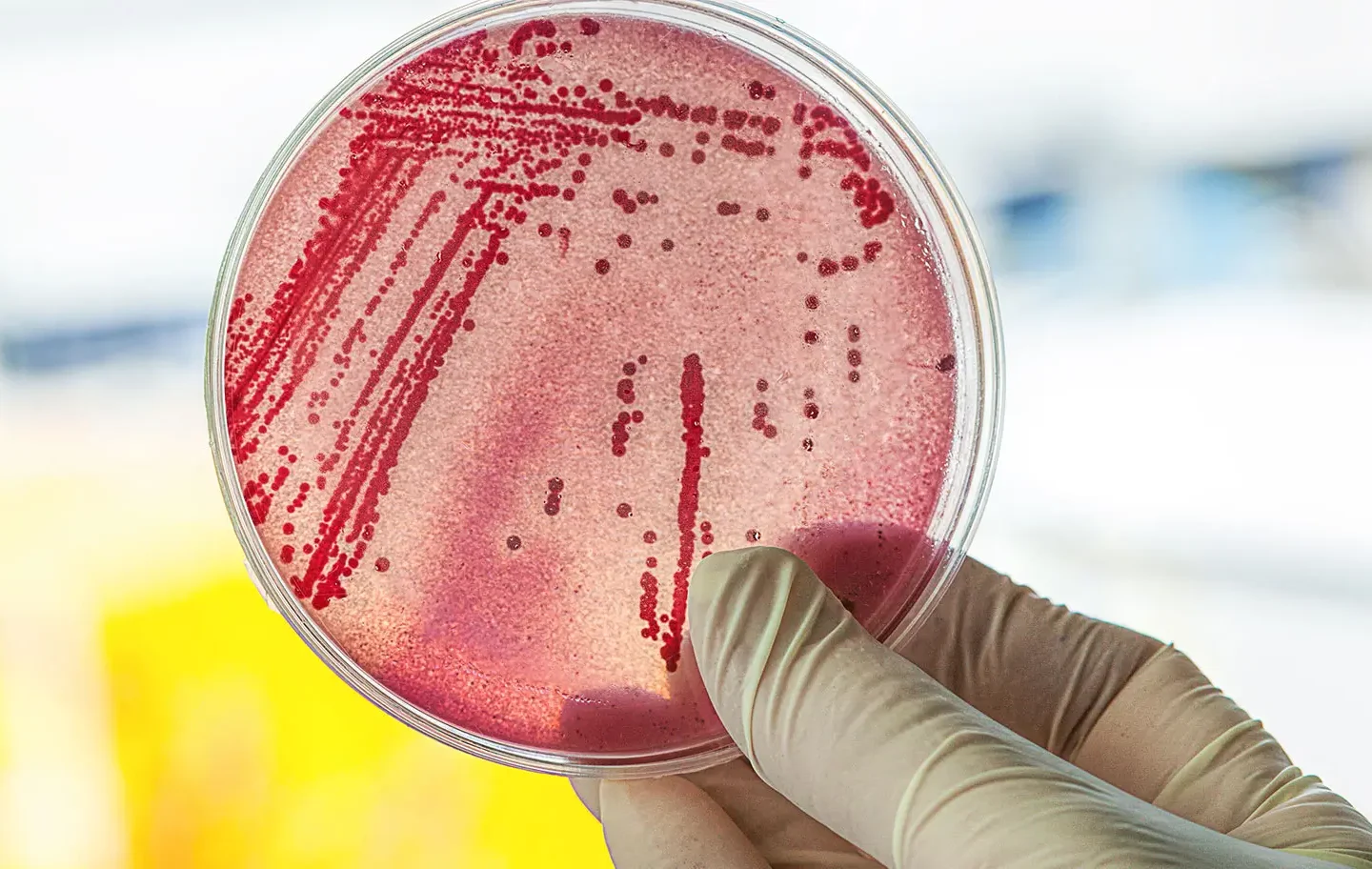 Escherichia coli